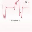  Heart Rate Monitoring:    iPhone